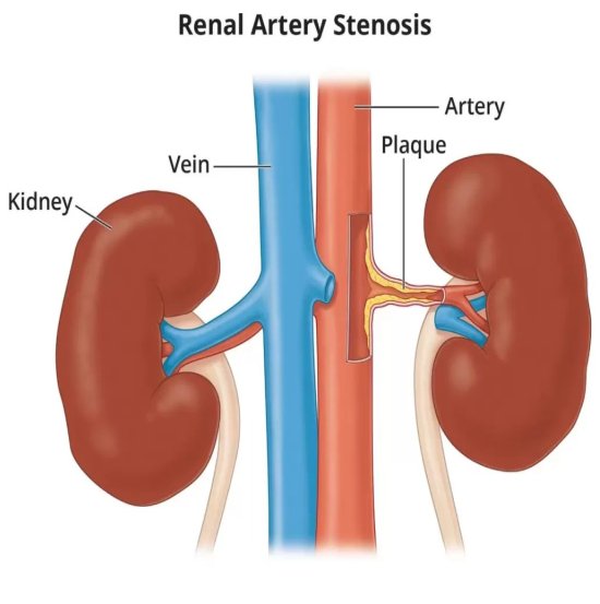 Interventional Radiology Equipment